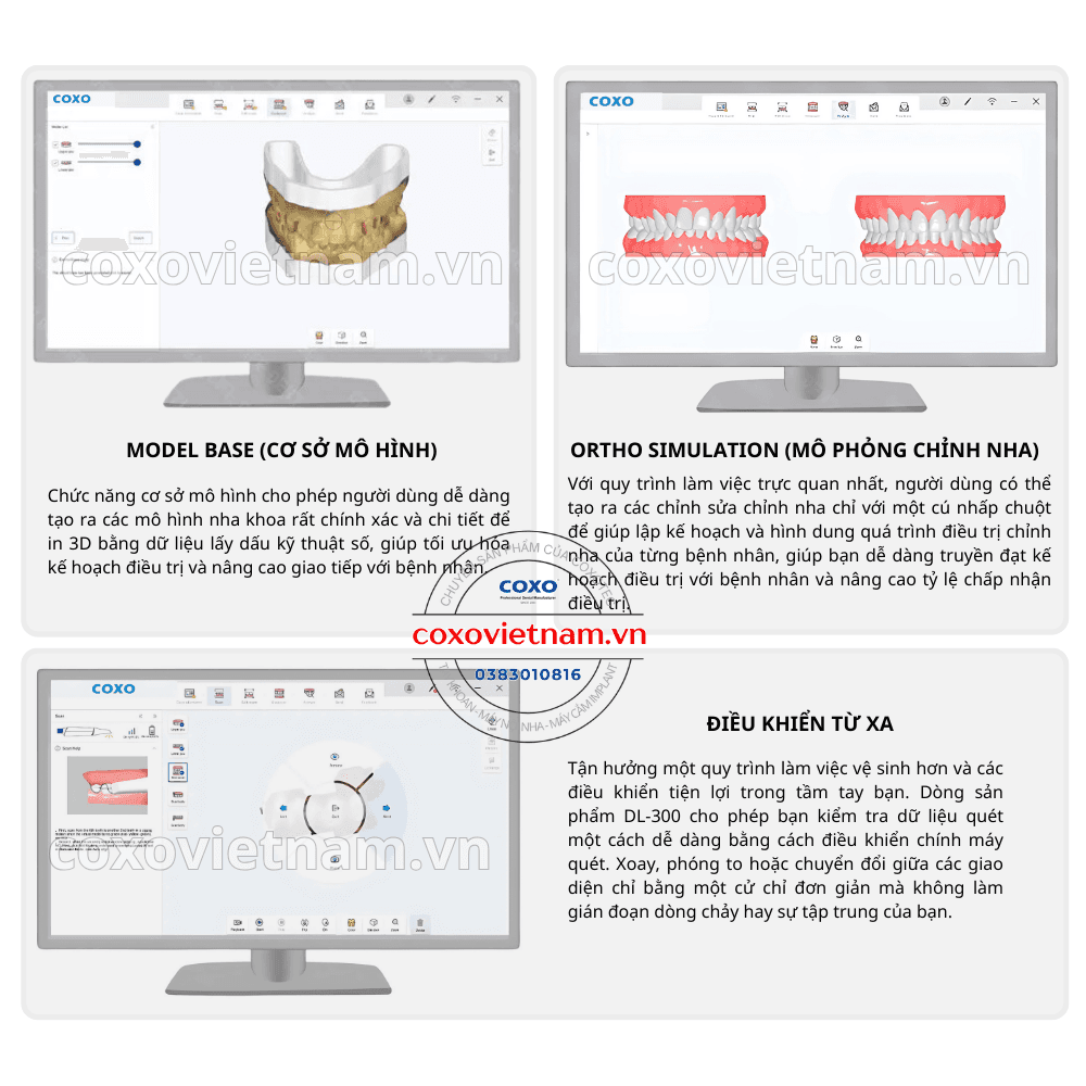 Máy scan trong miệng COXO DL-300P
