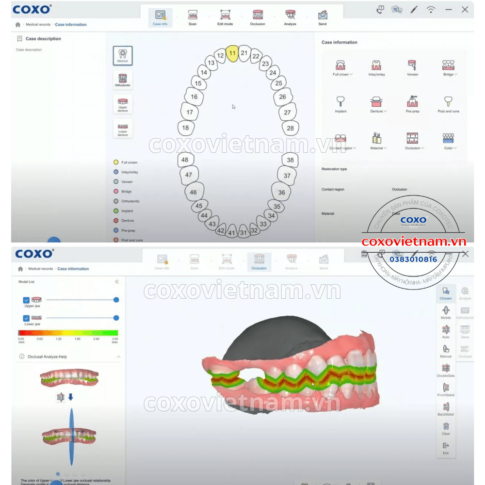 Máy scan trong miệng COXO DL-300P