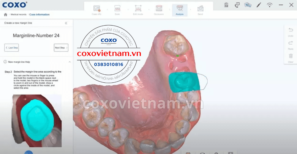 Máy scan trong miệng COXO DL-300P
